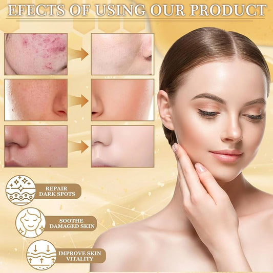 Hoygi - Mascarilla Hidratacion Profunda