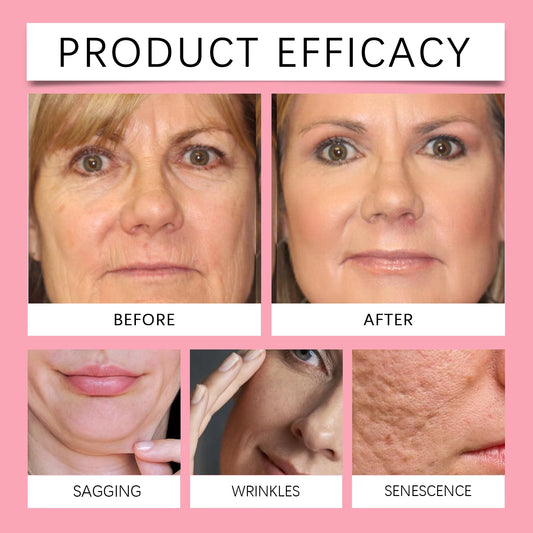 Ouhoe Mascarilla Exfoliante De Colágeno Con Cepillo De Aplicación, Antiarrugas, Reafirmante, Hidratante, Fácil Exfoliación, Todo Tipo De Piel, Limpieza No Irritante